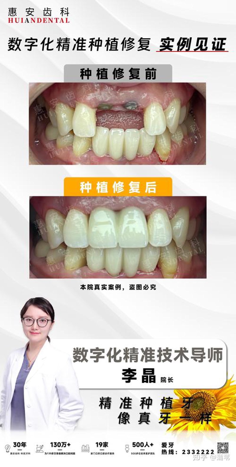 牙科诊所：守护口腔健康的前沿阵地