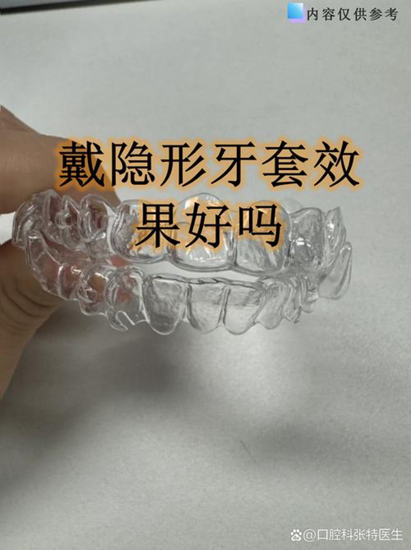 牙齿种植新技术：微笑革命
