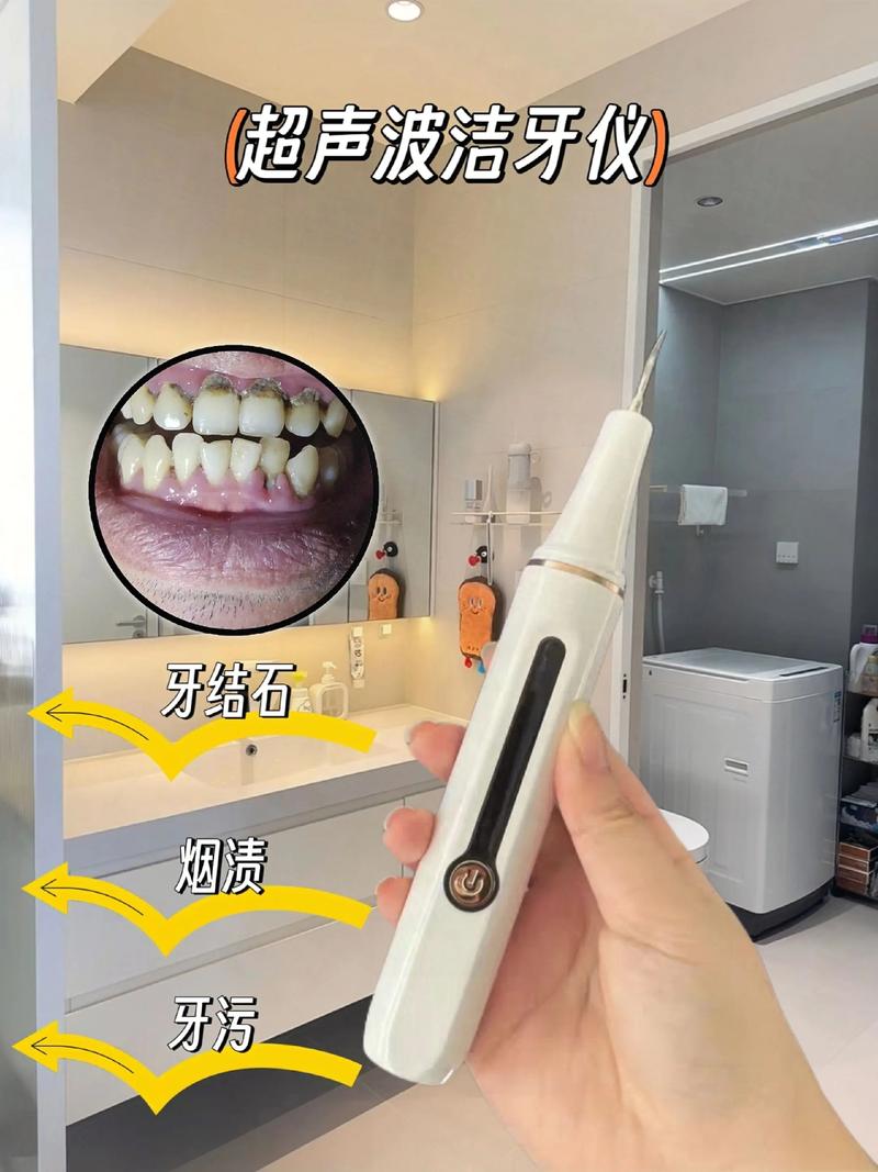 牙齿种植选购指南：为笑容增添无限风采
